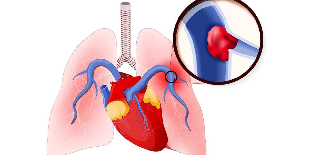 Best lung doctor in thane