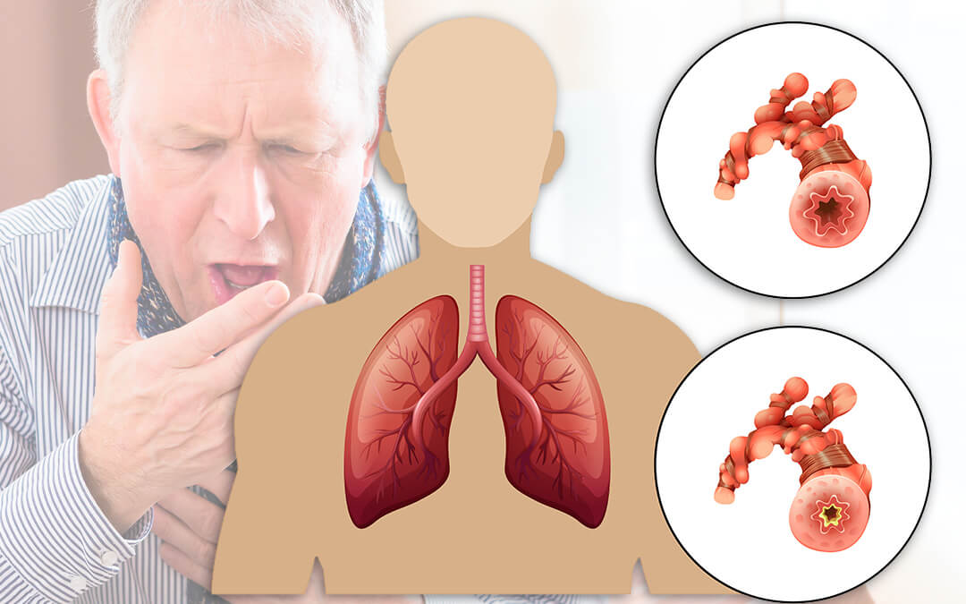 COPD treatment in thane